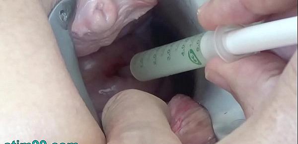 Insertion semen with syringe