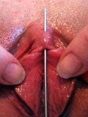 Clitoris pain