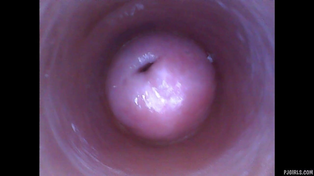 Endoscope stomach