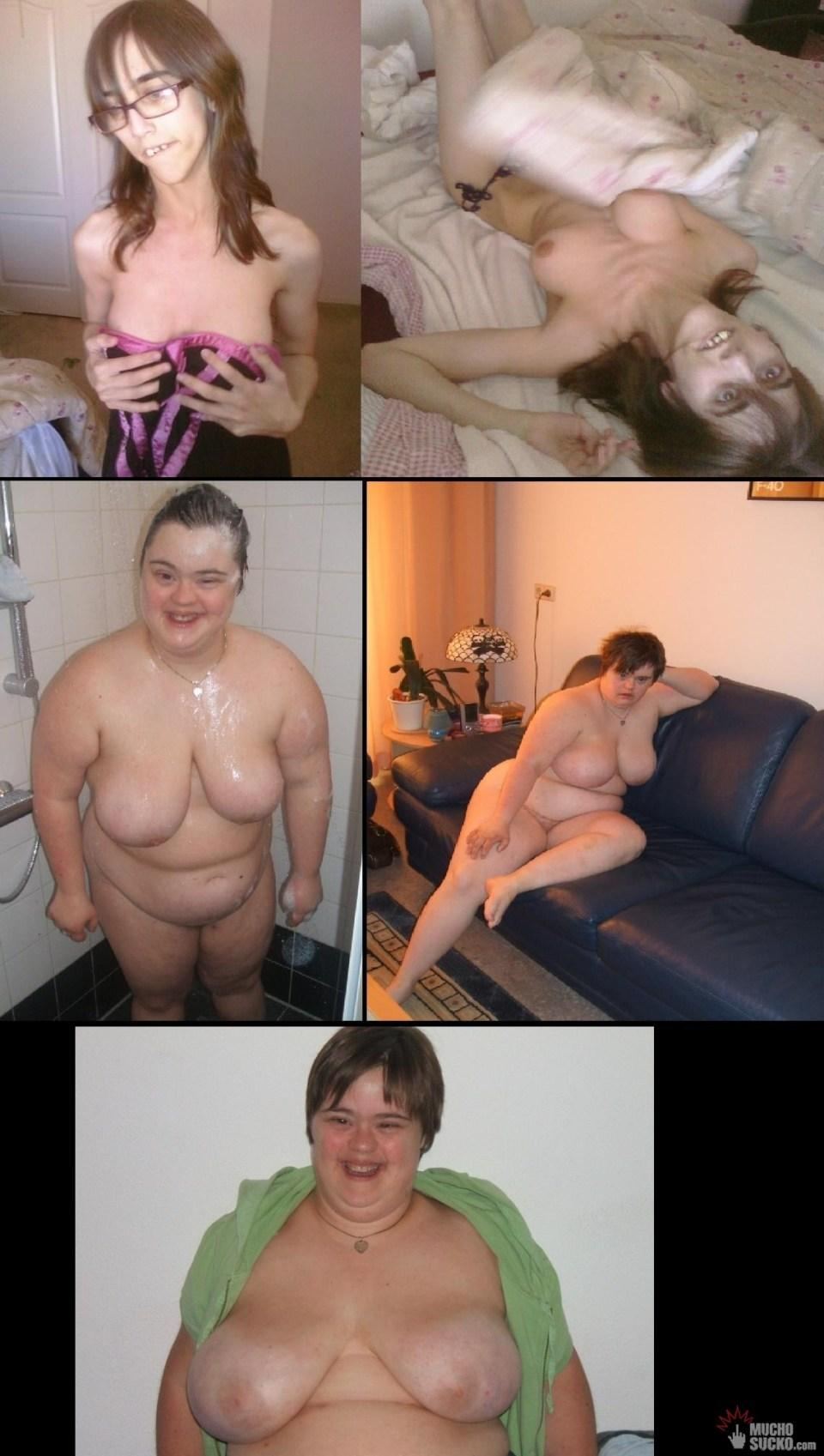Jetson reccomend nude retarded girls