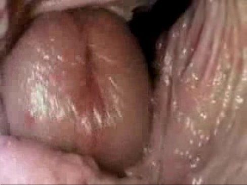 best of Torture cervix video porno hentay