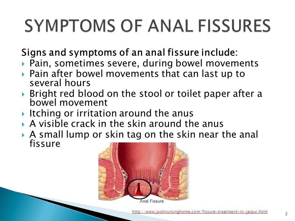 best of Pain Causes in anus of