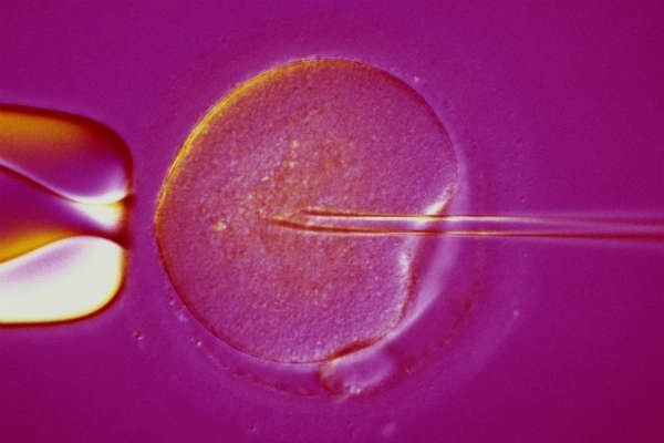 Engineer reccomend Remedy sperm abnormal morphology