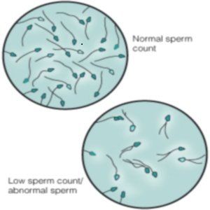 best of Morphology Remedy sperm abnormal