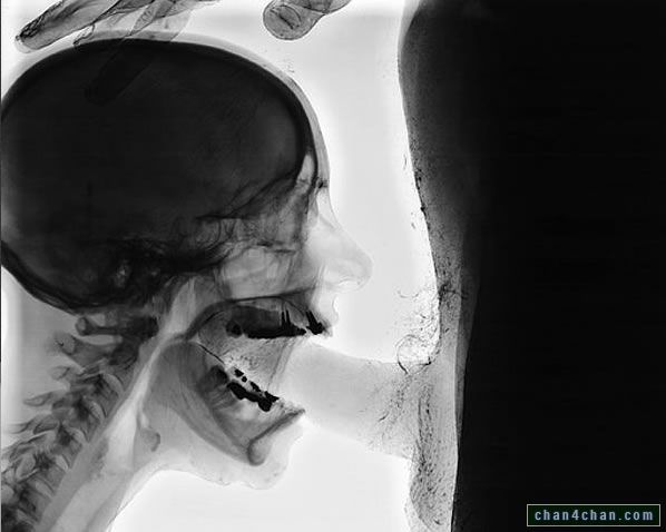 Funnel C. recommendet in mouth Xray picture cock of