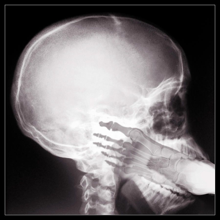 Road G. reccomend Xray picture of cock in mouth