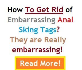 best of Tag removal skin Anal