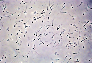 best of Under Sperm microscope size the