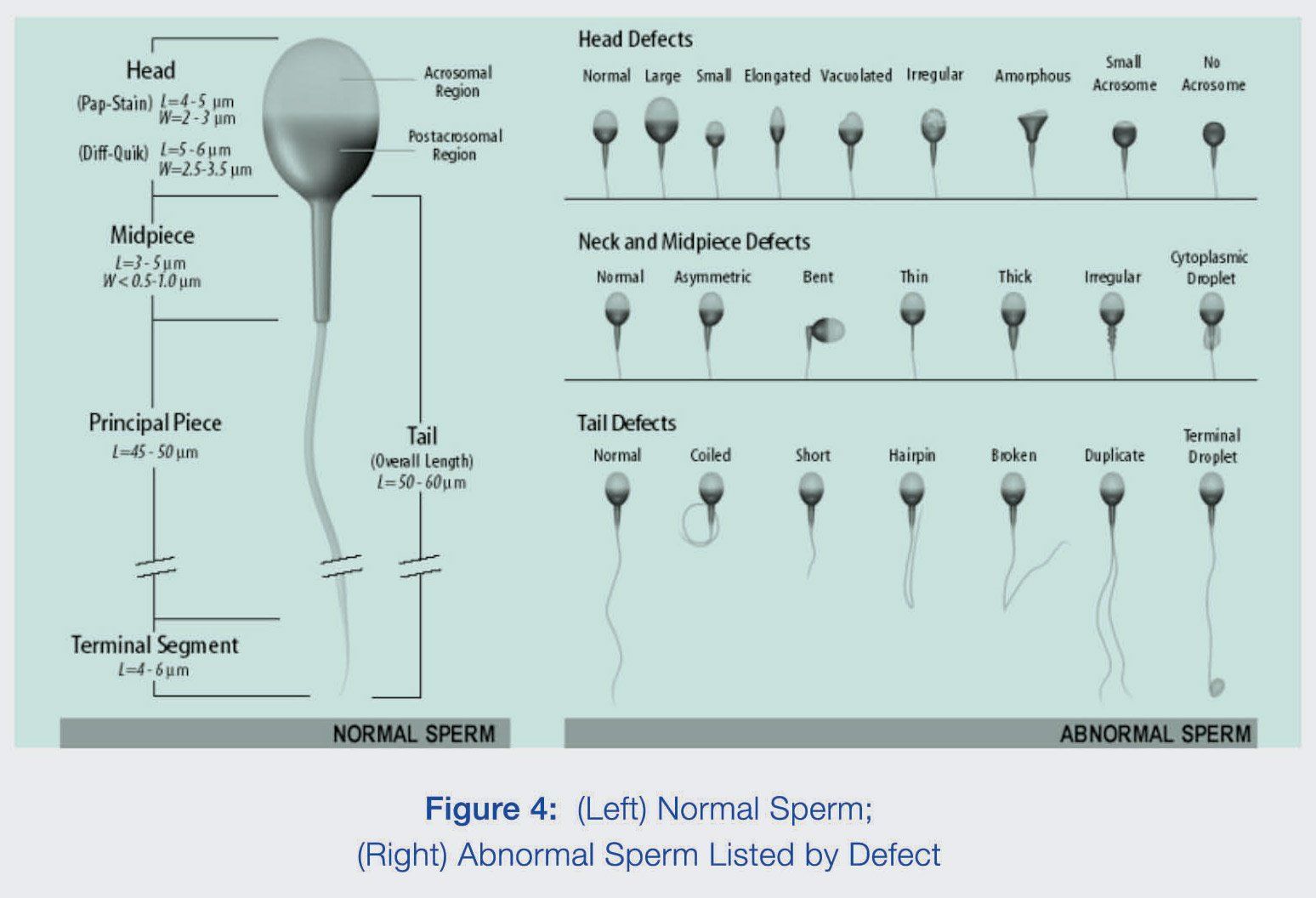 best of Morphology abnormal Remedy sperm