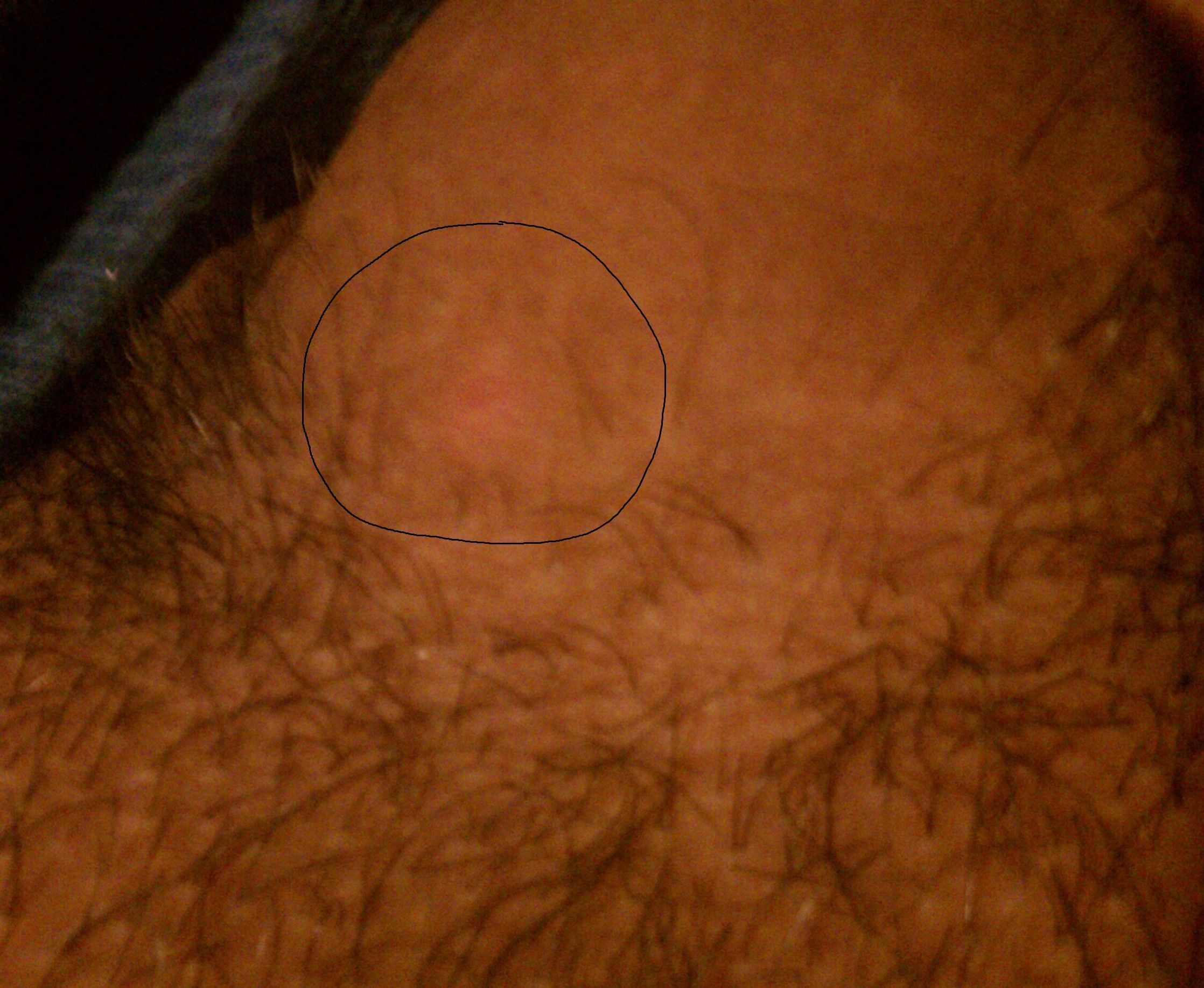 Gem recomended chest Itchy shaved