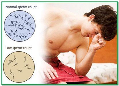 best of Count sperm for a Treatment low