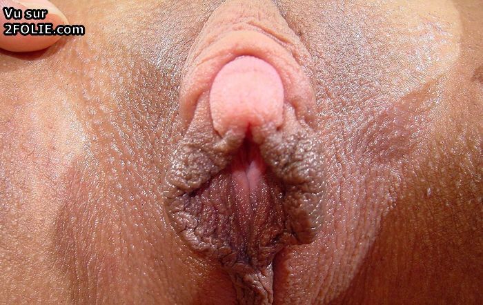 Enorme clitoris